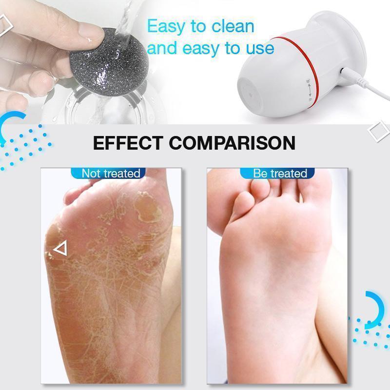 USB Rechargeable Vacuum Adsorption Foot Grinder